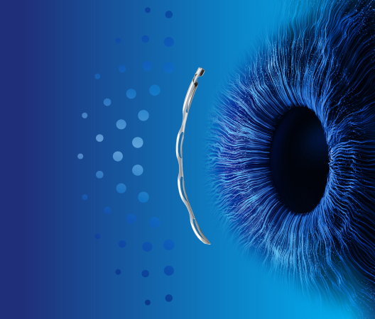 Image of the Eye and Hydrus Microstent