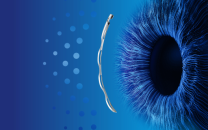 Image of the Eye and Hydrus Microstent