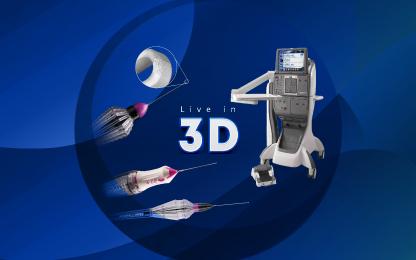 Alcon Eye to Eye – The Synergies between Skill and Technology (Live in 3D)