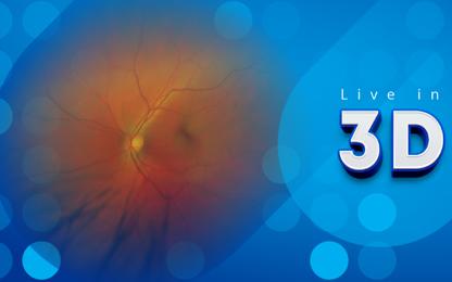 Live in 3D