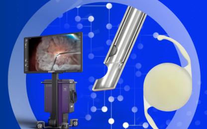 Alcon Vision Suite